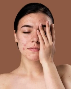 خدمات بوتاکس و فیلر در کلینیک دکتر خلیلی