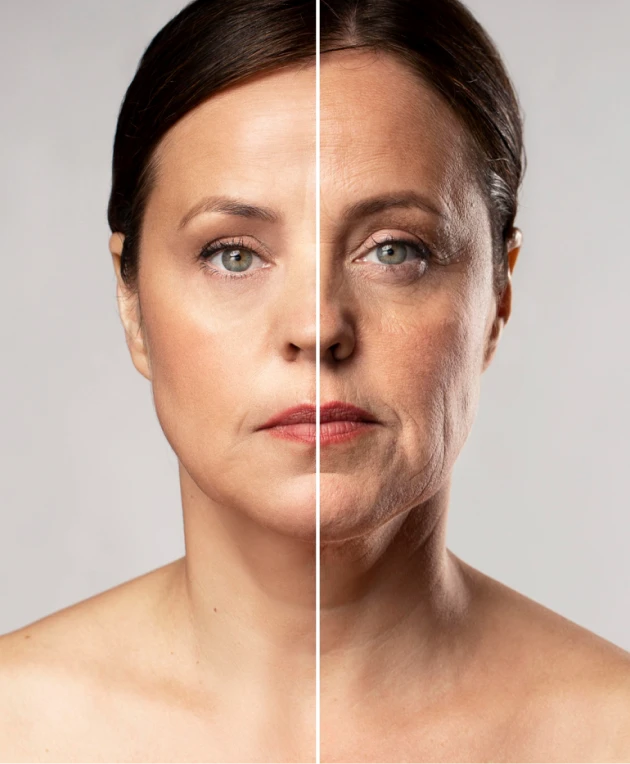 نمونه کار قبل و بعد اندولیفت بدن - کلینیک دکتر خلیلی