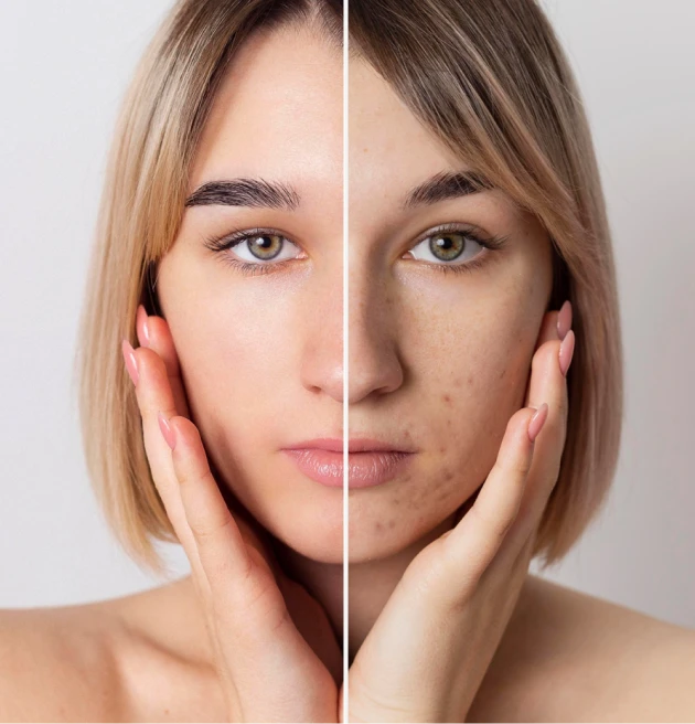 Body Endolift - جوانسازی پوست بدن